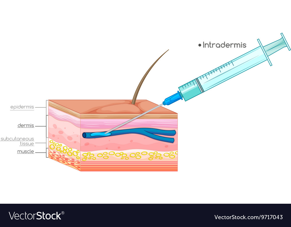 Diagram Showing Needle Injection On Skin Vector Image