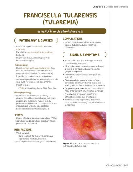 Francisella Tularensis (Tularemia): Video & Anatomy | Osmosis